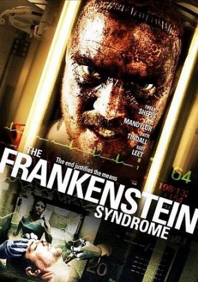 Смотреть фильм онлайн: Синдром Франкенштейна